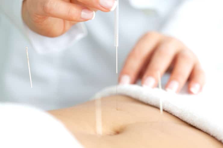 Chapman Acupuncture Clinic- Betty Rigi
